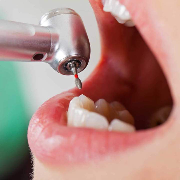 Dentisterie d’urgence Montréal