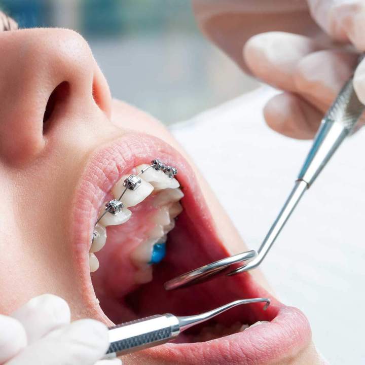 Dental care Montreal