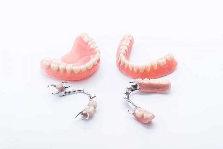 Une prothèse dentaire pour un sourire unique !