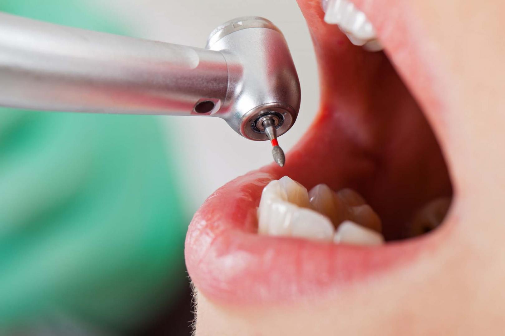 Dental treatments Monkland