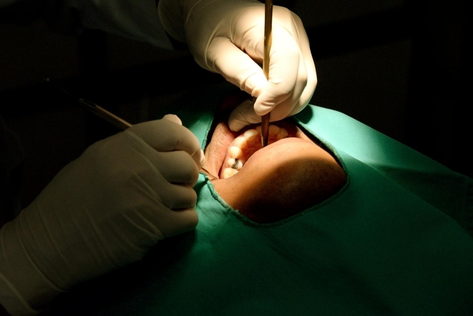 Dental implant Monkland